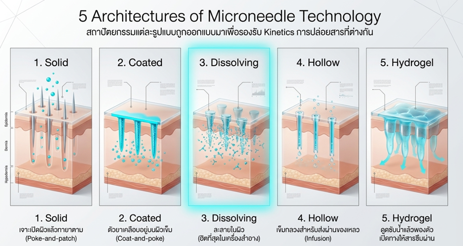 รูปที่ 1 ลักษณะของการปล่อยสารสำคัญด้วยเทคโนโลยี Microneedles (MNs)  